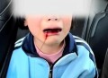 刀插入3岁女童颅脑,刀插在脑子里就没痛觉了吗