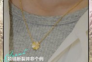 戴项链引发首饰病,戴金项链会引起颈椎头疼吗？