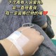 嘴含输液管陪女儿,生病了女儿陪我输液朋友圈说说？