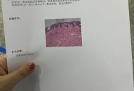 久坐屁股会变黑,屁股两侧发黑是怎么回事，怎么治疗呢？