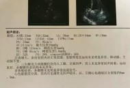 医院3万瓣膜卖28万,心瓣膜置换费用多少？