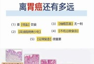 胃炎被当癌症切全胃,医生告知说3种胃病是癌前病变，哪3种？