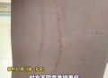 乘电梯被狗扑咬出血,为什么狗在电梯里面特别容易咬人？