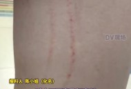 乘电梯被狗扑咬出血,为什么狗在电梯里面特别容易咬人？