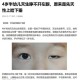 女婴眼睛小被挑剩下,女婴眼睛小,长长能变大吗