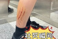 78岁演员倒地后去世,眼看90多岁邻居大娘上台阶摔倒，沈阳一78岁老工程师给小区安了21个扶手，你怎么看？