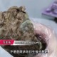 术后体内留纱布发臭,术后体内留纱布发臭怎么回事