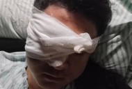 男子眼内取出7条活虫,男子眼内取出7条活虫视频