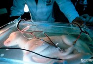 有公司开发人造子宫 ,人造子宫鲨鱼是什么意思？