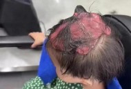 男子剪发耳朵被剪裂,男子剪发耳朵被剪裂视频