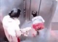 儿子被家中狗咬身亡,儿子被狗咬了怎么给他说？