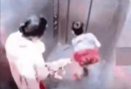 儿子被家中狗咬身亡,儿子被狗咬了怎么给他说？