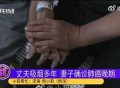 爸爸吸烟致儿子肺癌,我父亲得了癌症，可是还吸烟，我该怎么办？