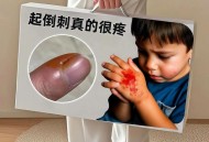 孩子手指被兔子咬掉,下午给兔子喂饭的时候，手伸过去摸了下兔子，可能兔子太饿了，就咬了我的手指，开始还以为没破皮，刚刚突？