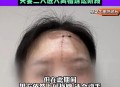 内蒙古刑事案致1死,复婚遭拒，内蒙古一男子用斧子砍死前岳父岳母，共导致三死三伤，你怎么看？