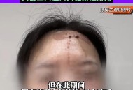内蒙古刑事案致1死,复婚遭拒，内蒙古一男子用斧子砍死前岳父岳母，共导致三死三伤，你怎么看？