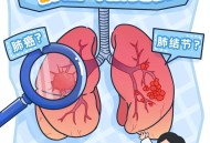 不抽烟的女性得肺癌,不吸烟的女性为何会得肺癌，该如何预防？