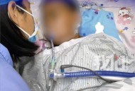 看教程做手术致死亡,做手术导致死亡