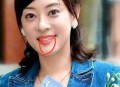 孙俪唇下痣没了,孙俪唇下痣是后来有的吗？