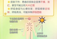 中暑的先兆症状,中暑的先兆症状不包括下列哪一项