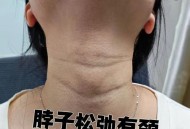 天鹅脖子疑被压变形,天鹅颈和普通脖子对比？