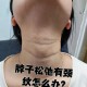 天鹅脖子疑被压变形,天鹅颈和普通脖子对比？