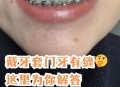 戴牙套5年坏了8颗牙,牙齿已经带了牙套，牙齿又开裂了，会怎么样？