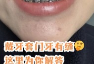 戴牙套5年坏了8颗牙,牙齿已经带了牙套，牙齿又开裂了，会怎么样？
