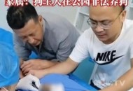乘电梯被狗扑咬出血,为什么狗在电梯里咬人特别多？