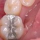 网购5元材料自行补牙,淘宝补牙的材料靠谱吗？