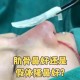 3万隆鼻熟人拿走2万,用别人的肋软骨隆鼻有哪些危害？