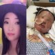 24岁男子驾车致7伤,24岁车祸死亡最多赔多少钱