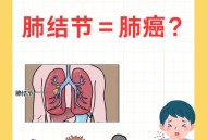 咳嗽不止查出肺癌,咳嗽老是不好会是肺癌吗？