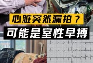 学生体测心源性猝死,请问心源性猝死是什么情况？