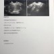 痛经去医院结果生了,孕晚期有大便和痛经感是快生了吗？