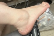 亲10月龄娃脚后嘴肿,脚踝骨肿是怎么回事？