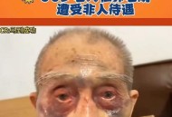8旬老人被卡墙缝2天,柳州：老汉掉入四面封闭墙缝中，头部有血迹、动弹不得, 你怎么看？