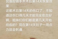 术后体内留纱布50天,开腹手术后多久把纱布取下来？