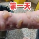 男童被沸水烫伤下肢,衣服用开水烫会怎么样？