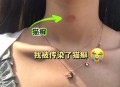 买猫被传染满脸猫藓,买了个得猫癣的猫怎么办，在宠物店买的猫有猫癣？