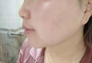 婴儿出生时脸部裂开,为什么化完妆脸上会开裂？