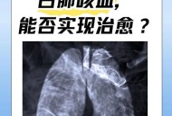 发热1天左肺全白,左肺发白,晚上发烧白天正常