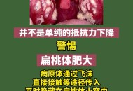 喉咙痛咽喉长满雪花,喉咙痛咽喉长满雪花状疙瘩