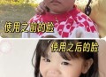 婴儿出生时脸部裂开,小孩冬天脸部干燥开裂涂什么面霜？