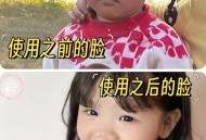 婴儿出生时脸部裂开,小孩冬天脸部干燥开裂涂什么面霜？