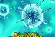 美爆发接吻虫病疫情,亲吻虫有毒吗？