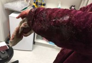 火化前突然苏醒求救,火化的时候突然醒来还有生还机会吗？