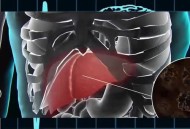 患癌肝被肿瘤占近半,肝的恶性肿瘤长在肝里面是不是比长在表面更危险？