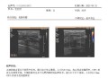 爱康国宾情况说明,爱康国宾体检报告如何查看？
