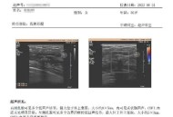 爱康国宾情况说明,爱康国宾体检报告如何查看？